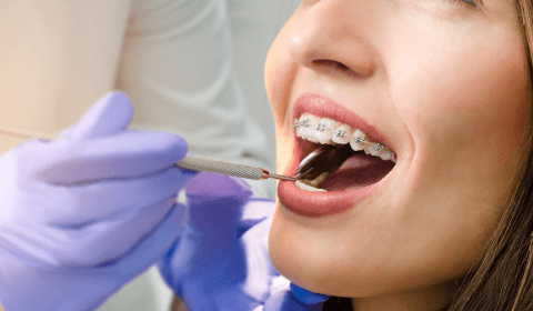 The Evolution Of Orthodontics From Traditional To Digital Solutions
